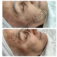 پاکسازی تخصصی پوست یک حس متفاوت