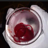 حجامت در منزل ۵۰۰تومن