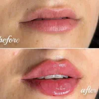 ژل لب و ...|خدمات آرایشگری و زیبایی|مشهد, گلبرگ|دیوار