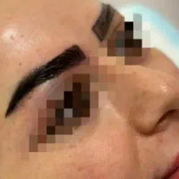 فرصت ویژه کاشت ابرو حرفه ای