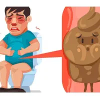 یبوست مزمن / هشدار قرمز