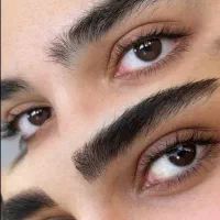 تخفیف ویژه فیبروز تخصصی و شید لب بدون درد
