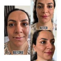 کلینیک زیبایی/ژل/بوتاکس/فیلر