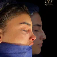 فقط با 40تومن بینی تو عمل کنی
