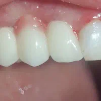 dentist endo|خدمات آرایشگری و زیبایی|کرمانشاه, |دیوار