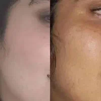 کرم سفید کننده فوری اماراتی