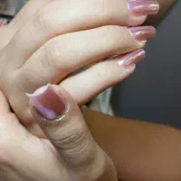 ترمیم و کاشت اولیه
