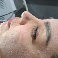 پاکسازی زیبایی پزشکی همیشه تخفیف/ آقایان و بانوان/