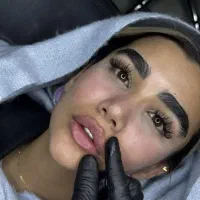 جشنواره ژل،بوتاکس،فیشال پوست،برداشتن خال و کک و مک