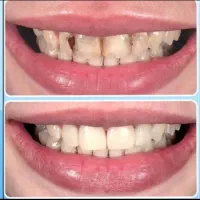 کلینیک دندان پزشکی رویای لبخند