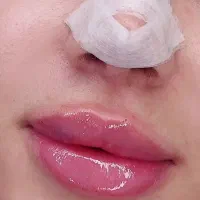 جشنواره تزریق فیلر لب،گونه،زاویه فک،چونه