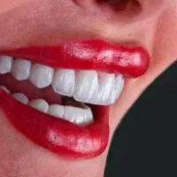 کامپوزیت دندان ژاپنی آلمانی 2 تومن