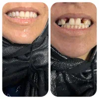 دندان|خدمات آرایشگری و زیبایی|ساوه, |دیوار