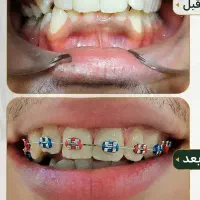 ارتودنسی و ایمپلنت  اقساطی
