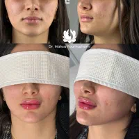 خدمات کامل جوانسازی و زیبایی صورت