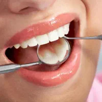 دندانپزشکی اقساطی