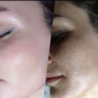 کرم روشن کننده و ضدلک صددردصد تضمینی وایت رز