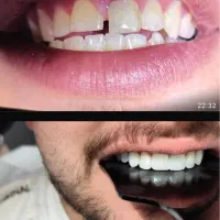 خدمات دندانپزشکی تخفیف ویژه لبخند زیبا