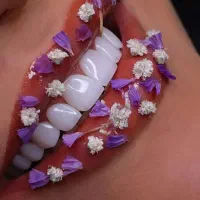 کامپوزیت لمینیت روکش ونیر عصب کشی imax