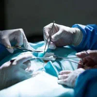 لابیاپلاستی