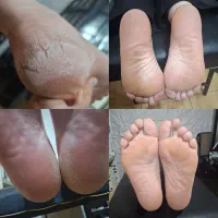 پدیکور تخصصی بانوان با قیمت استثنایی