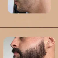 رویش تضمینی دائمی