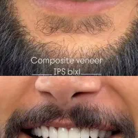 دندانپزشکی اقساطی