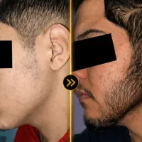 ریش|آرایشی، بهداشتی، درمانی|تویسرکان, |دیوار