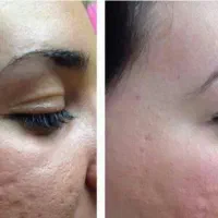 فیشال تخصصی با به روز ترین دستگاه ومواد کلینیکال