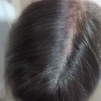 کلاه کیس، پستیژ