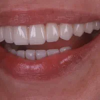 همکاری در زمینه دندادنپزشکی