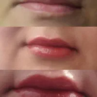 میکروبلیدینگ  وشید لب  فقط فقط ۵۰۰