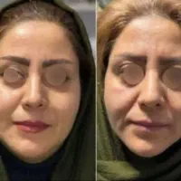 بیوممتیک، جوانساز، فرانسوی، ایتالیایی، اسپانیایی