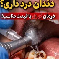 عصب کشی ۳۲۰۰/ روکش ۳۹۰۰/ جشنواره دندانپزشکی