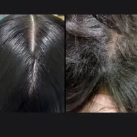 د. پاکسازی رشک و شپش تضمین کتبی