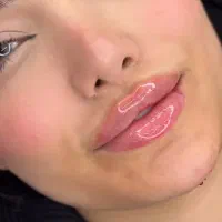 تزریق ژل فقط ۱تومن