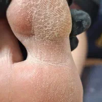 جشنواره بهاره پدیکور و کفسابی پا