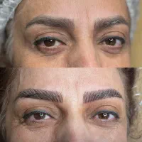 میکروبلیدینگ ابرو با متد پیشرفته و قیمت عالی 990