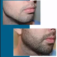 نتیجه ی کمتر از یک ماه