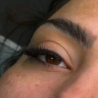 کاشت مژه۱۹۹ اصلاح ۷۰