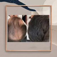 موهاتو پرپشت کن