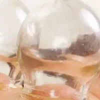 حجامت درمانی /روستای ژاله ای