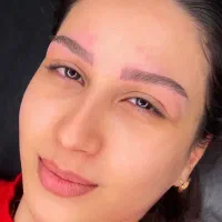 تخفیف ویژه میکروبلیدینگ
