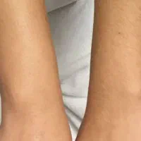 دیگه از تیغ و لیزر استفاده نکن
