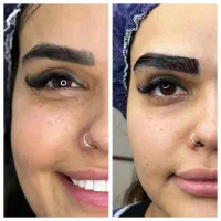 کاشت ابرو با بیشترین تراکم