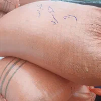 فروش سبوس برنج(اکوته)