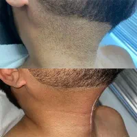 مرکز لیزر و زیبایی (کلینیک هایلین)