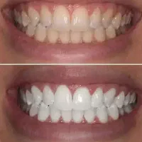 دندان سازی و داندان پزشکی و مصنوعی