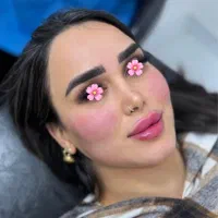 ژل و بوتاکس