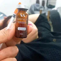 اانجام خدمات ژل وبوتاکس